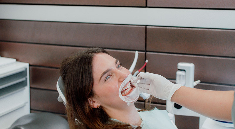Veneers für Hamburg, Bleaching: schöne Zähne, Ästhetik